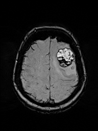MRI view